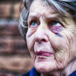 A senior woman, very wrinkled and with two black eyes, looks up, nervously.